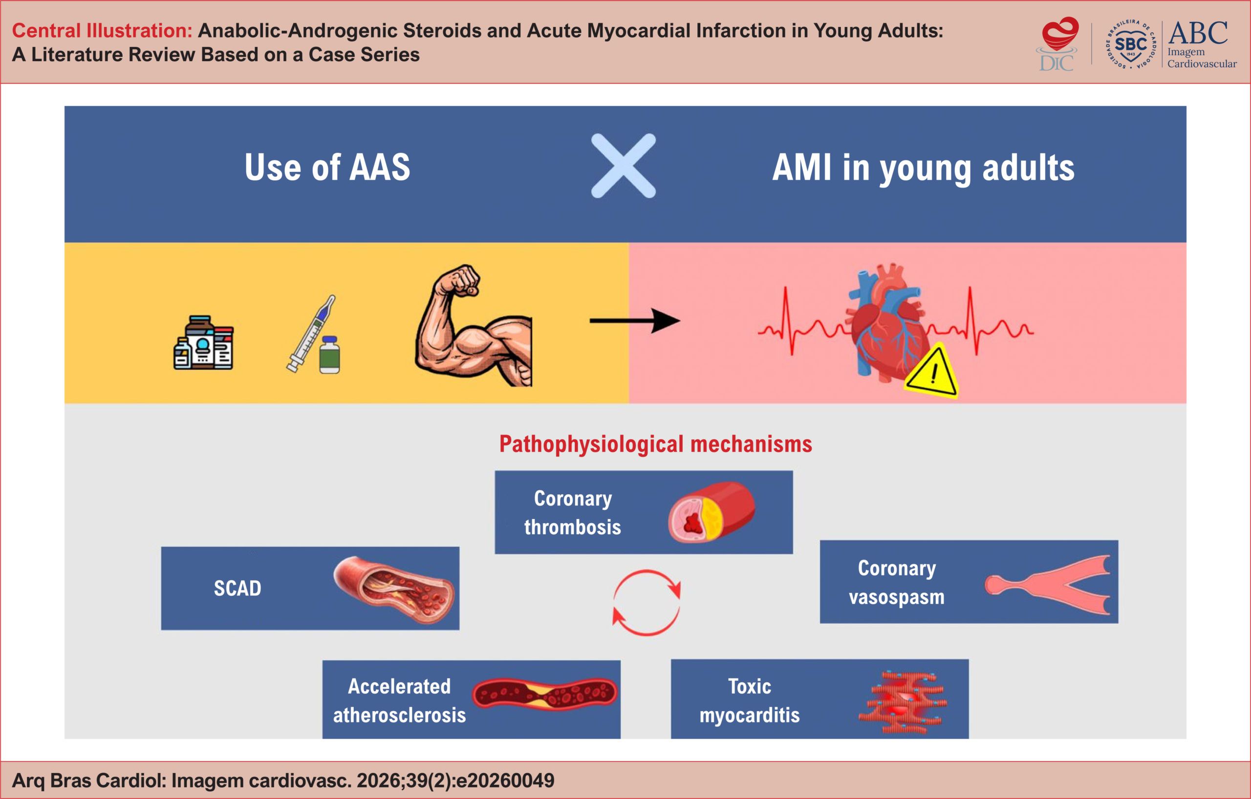 Anabolic-Androgenic Steroids and Acute Myocardial Infarction in Young Adults: A Literature Review Based on a Case Series