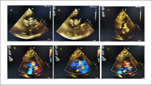 Figura 1