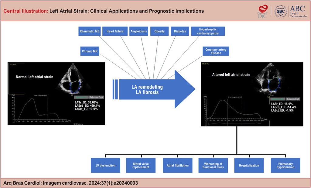 LA: left atrium; LAScd_ED: left atrial strain in the conduit phase in end diastole; LASct_ED: left atrial strain in the contractile phase in end diastole; LASr_ED: left atrial strain in the reservoir phase in end diastole; LV: left ventricle; MR: mitral regurgitation; MS: mitral stenosis.