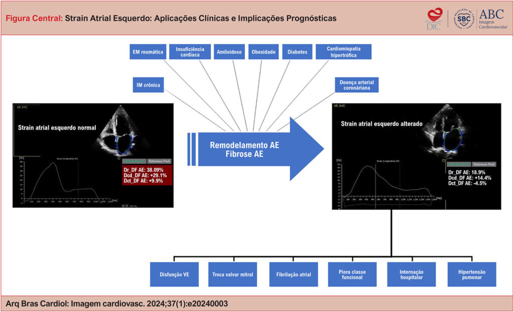 AE: átrio esquerdo; Dcd_DF AE: strain atrial esquerdo na fase de conduto na diástole final; Dct_DF AE: strain atrial esquerdo na fase contrátil na diástole final; Dr_DF AE: strain atrial esquerdo na fase de reservatório na diástole final; EM: estenose mitral; IM: insuficiência mitral; VE: ventrículo esquerdo.