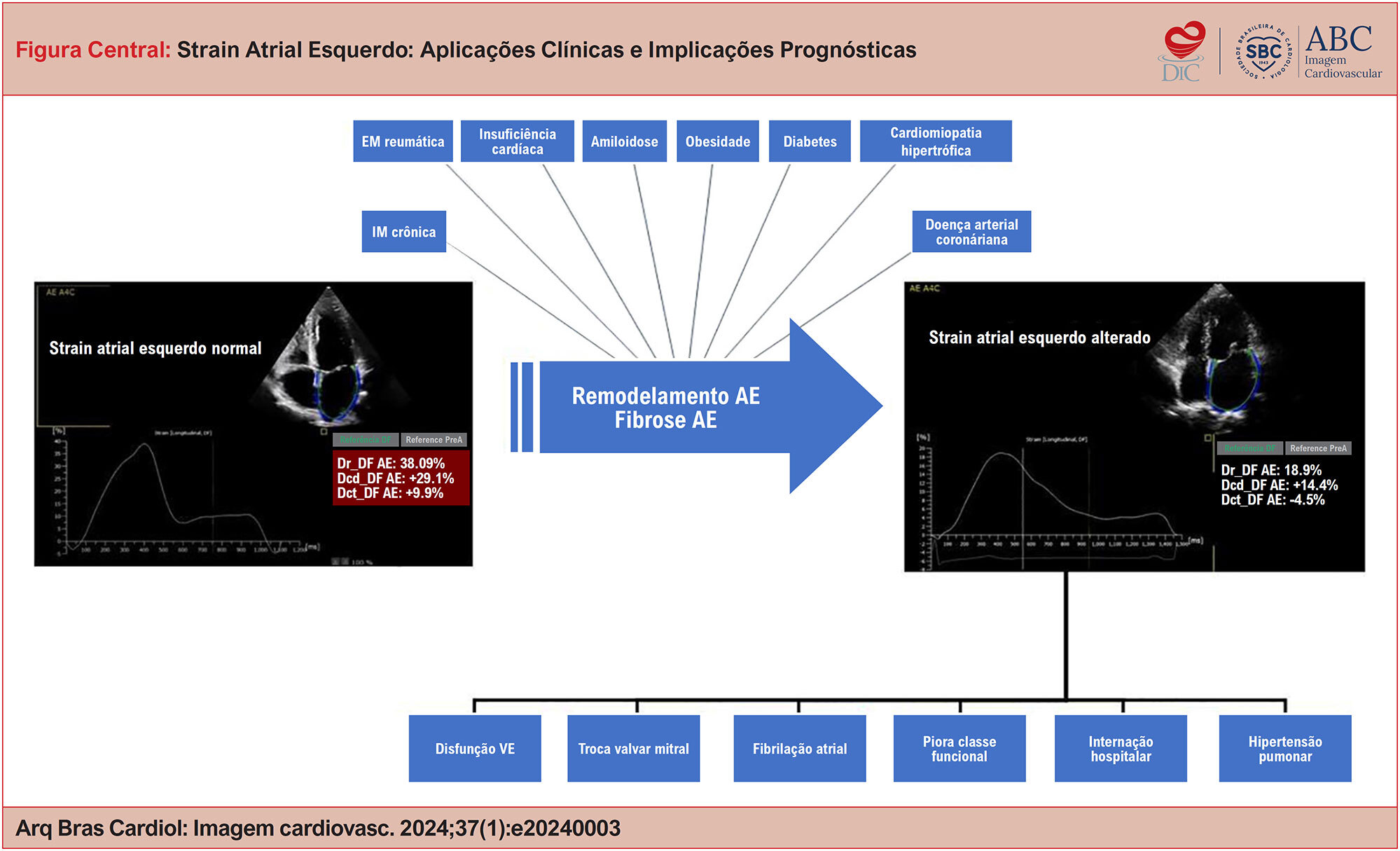 Strain Atrial Esquerdo: Aplicações Clínicas e Implicações Prognósticas