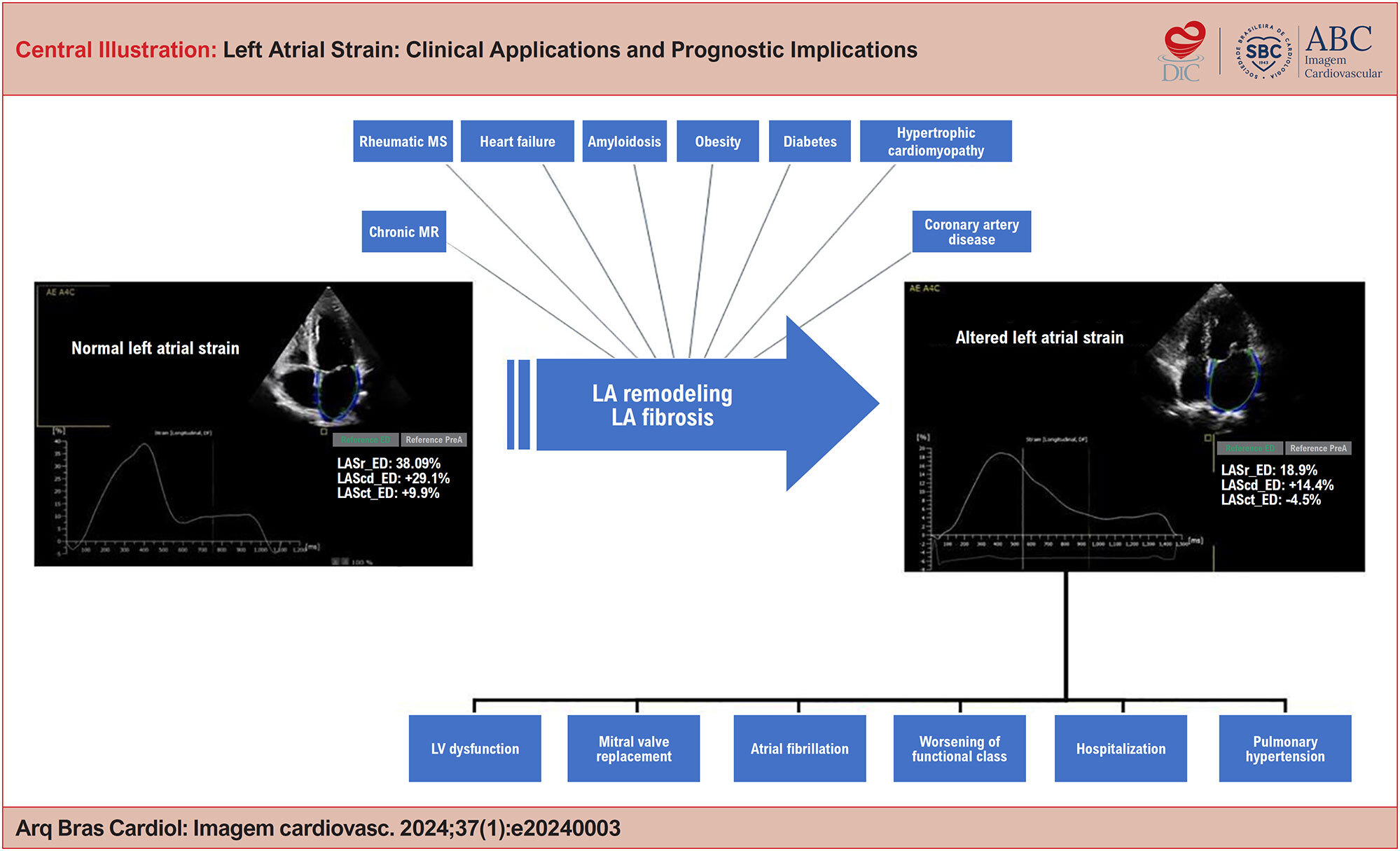 Left Atrial Strain: Clinical Applications and Prognostic Implications