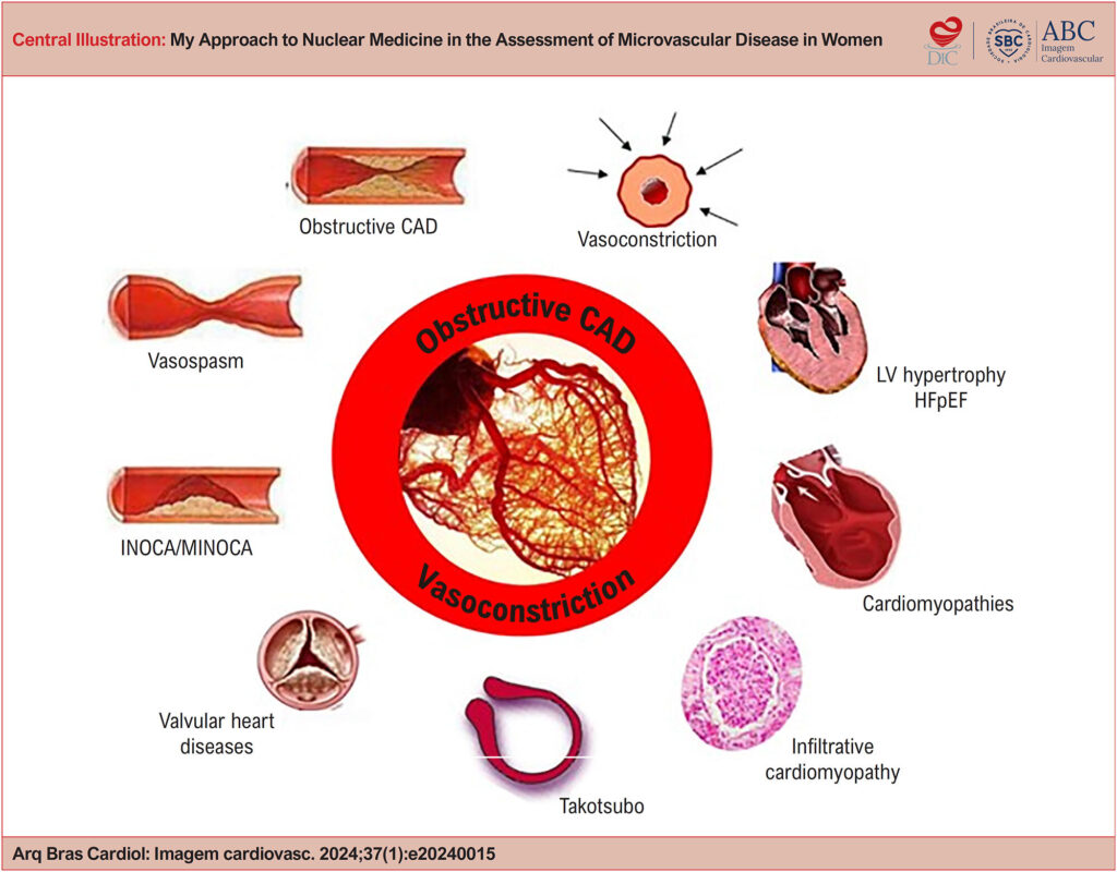 Role of coronary microvascular dysfunction in different cardiovascular diseases .CAD: coronary artery disease; HFpEF: heart failure with preserved ejection fraction; INOCA: ischemia with non-obstructive coronary arteries; LV: left ventricular; MINOCA: myocardial infarction with non-obstructive coronary arteries: CMD: Coronary microvascular dysfunction.