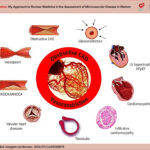 Role of coronary microvascular dysfunction in different cardiovascular diseases .CAD: coronary artery disease; HFpEF: heart failure with preserved ejection fraction; INOCA: ischemia with non-obstructive coronary arteries; LV: left ventricular; MINOCA: myocardial infarction with non-obstructive coronary arteries: CMD: Coronary microvascular dysfunction.