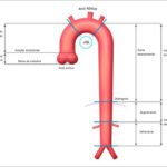 Figura 1