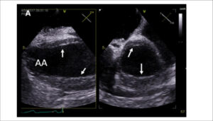 Figura 9