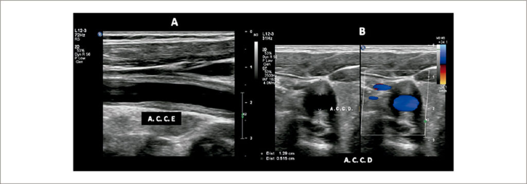 Figura 4