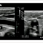 Figura 4