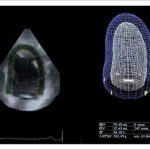 Figura 2