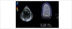 Figura 2