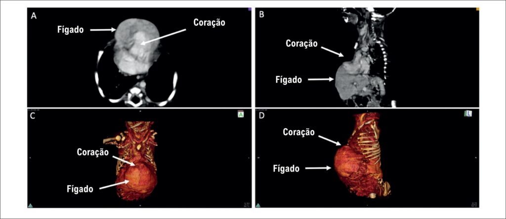 Figura 2