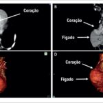 Figura 2