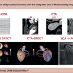 Example of multimodal assessment in the investigation of CAD in a patient with chronic coronary syndrome. CTA: coronary computed tomography angiography; ECG: electrocardiogram; ICA: invasive coronary angiography; LAD: left anterior descending artery; LCX: left circumflex artery; PCI: percutaneous coronary intervention; RCA: right coronary artery; SPECT: single-photon emission computed tomography.