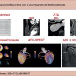 Exemplo de avaliação multimodal de investigação de DAC em paciente com síndrome coronariana crônica. ACD: artéria coronária direita; ACI: angiografia coronária invasiva; ACXE: artéria circunflexa esquerda; ADAE: artéria descendente anterior esquerda; ATC: angiotomografia coronariana; ECG: eletrocardiograma; ICP: intervenção coronária percutânea; SPECT: tomografia computadorizada por emissão de fóton único.