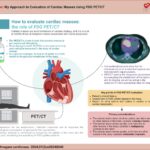 The role of FDG-PET/CT in evaluating and diagnosing cardiac masses of variable etiologies. PET/CT: positron emission tomography/computed tomography; FDG: fluorodeoxyglucose labeled with fluorine-18. Image made with BioRender.com.