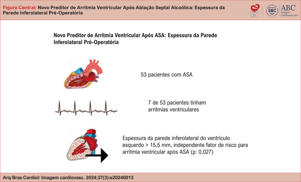 ASA: ablação septal alcoólica