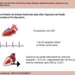 ASA: ablação septal alcoólica