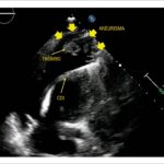 Figura 2