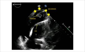 Figura 2