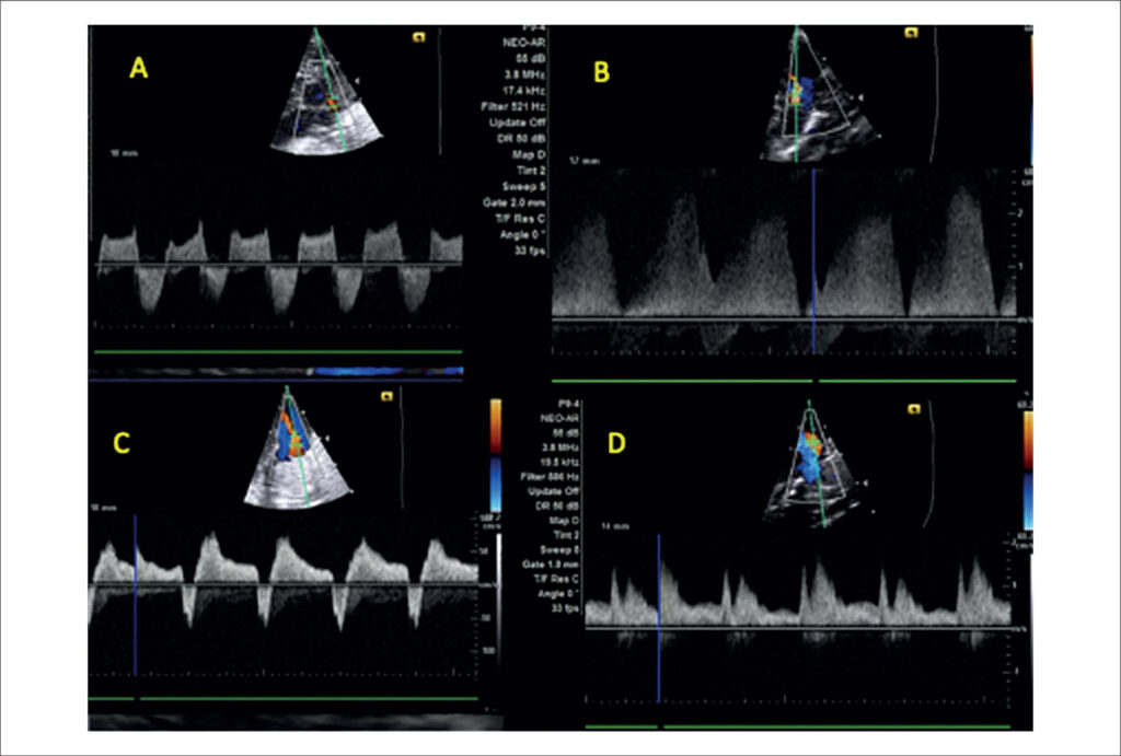 Figure 4