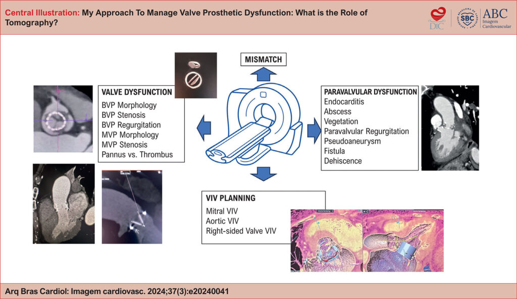 Utility of CT in Valve Prosthesis Dysfunction. BVP: Biological valve prosthesis, MVP: Mechanical valve prosthesis, VIV: Valve-in-valve; CT: computed tomography
