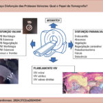 Utilidade da tomografia na disfunção das próteses valvares. PVB: Prótese valvar biológica, PVM: Prótese valvar metálica; VIV: valve-in-valve.