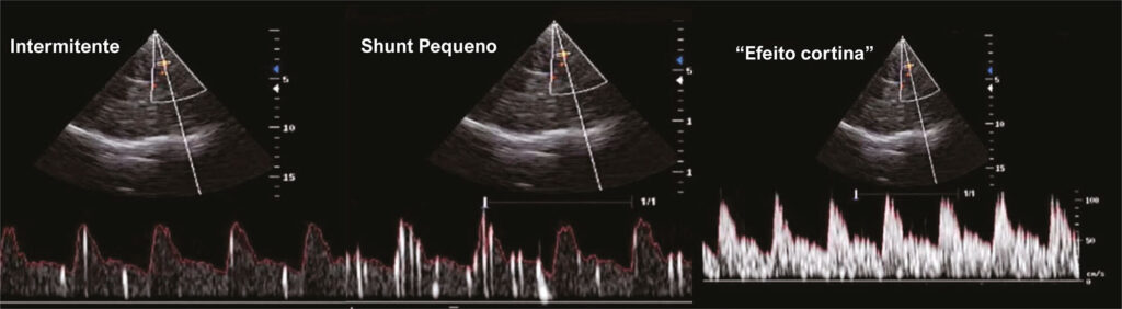 Figura 2