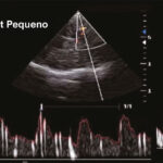 Figura 2