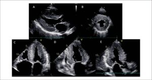 Figura 1