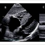 Figura 2