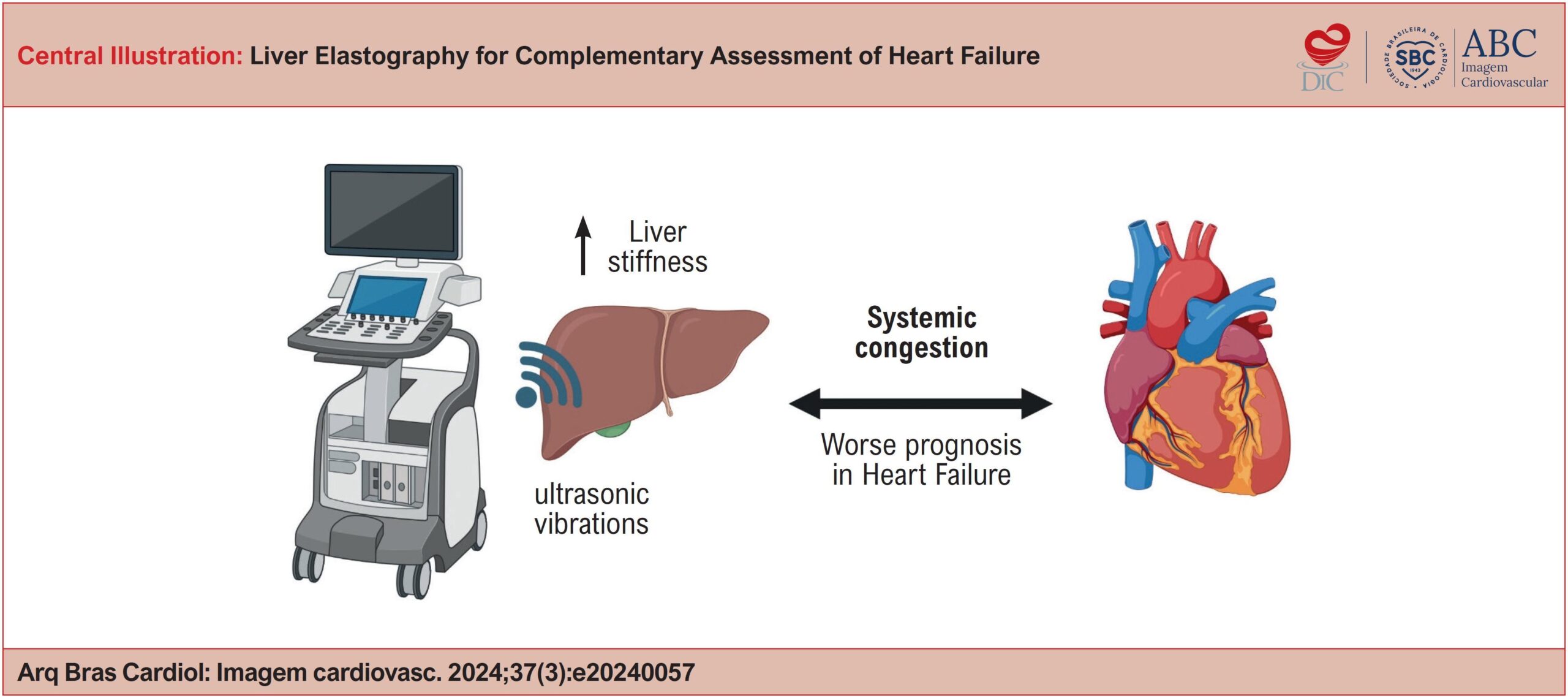 Liver Elastography for Complementary Assessment of Heart Failure