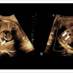 Figura 1