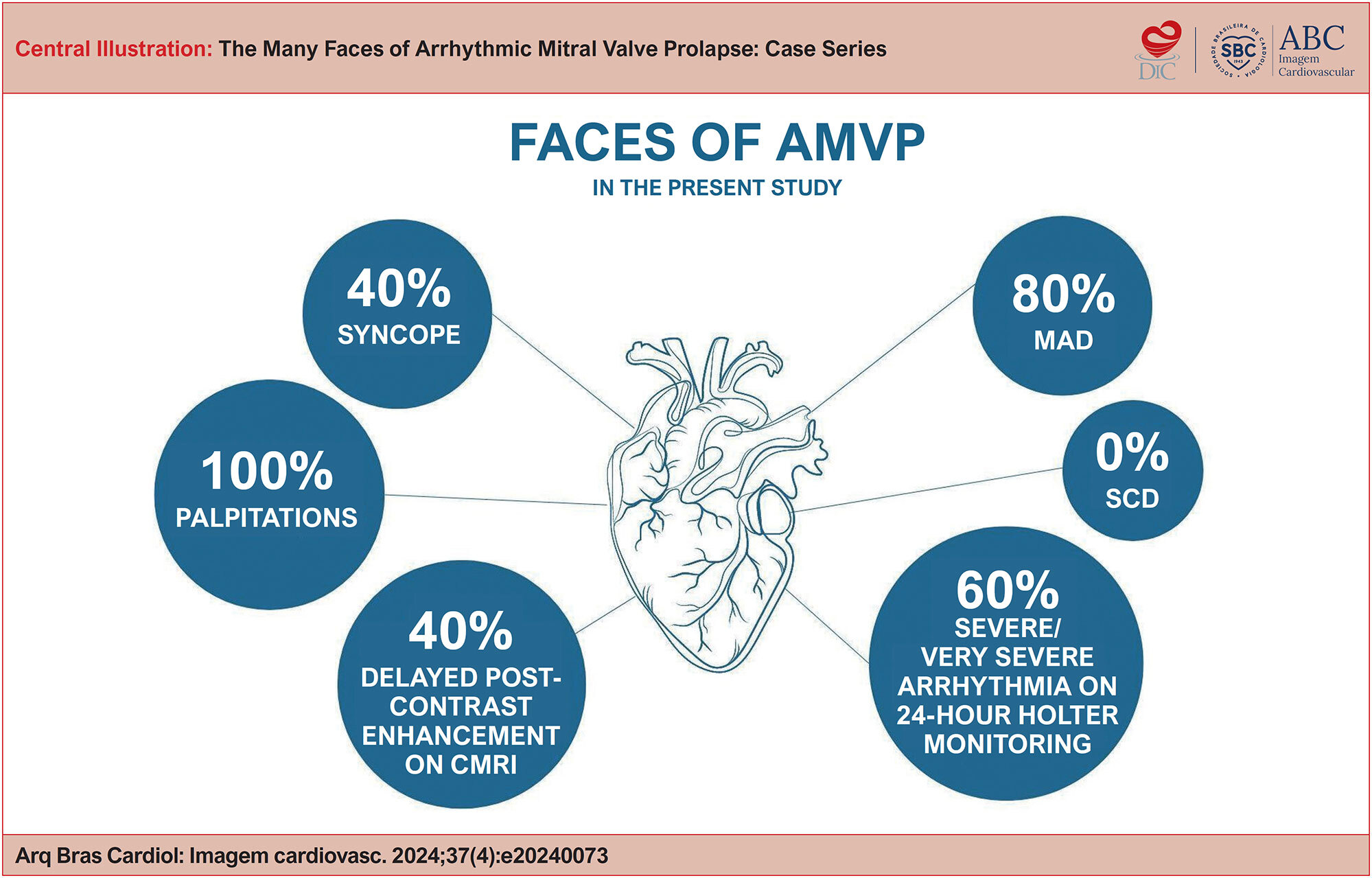 The Many Faces of Arrhythmic Mitral Valve Prolapse: Case Series