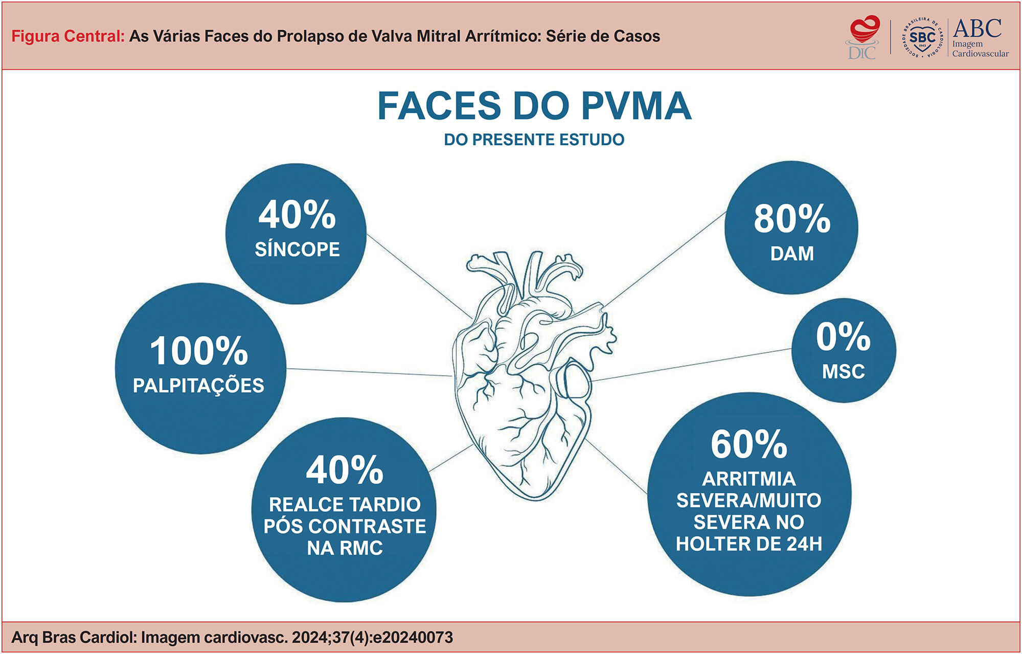 As Várias Faces do Prolapso de Valva Mitral Arrítmico: Série de Casos