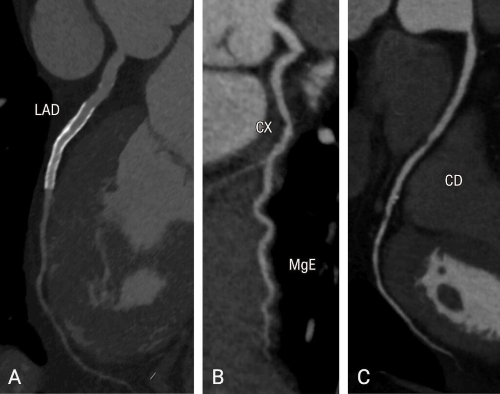 Figure 12