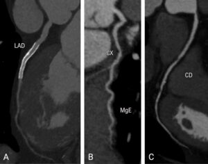 Figure 12