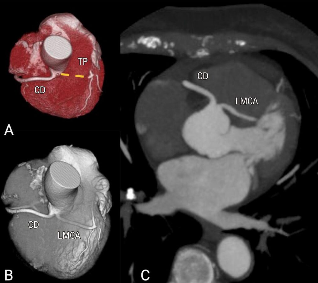Figure 16