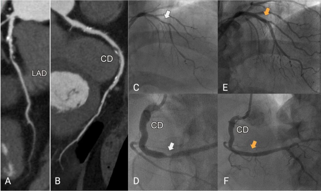 Figure 17