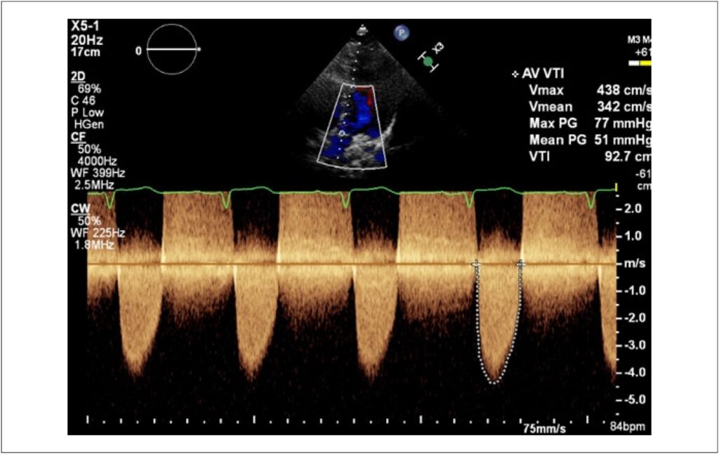 Figura 1