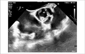 Figura 2