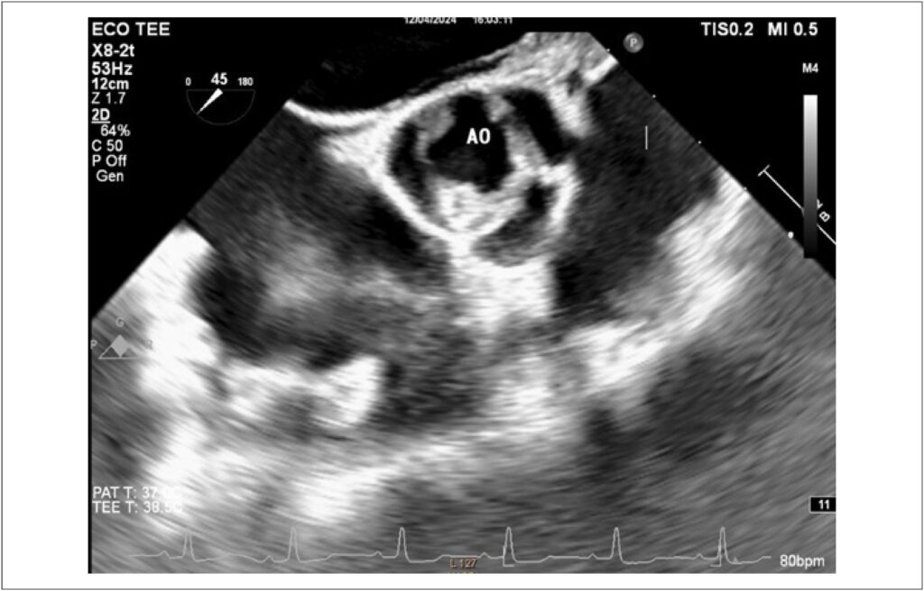 Figura 2