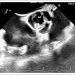 Figura 2