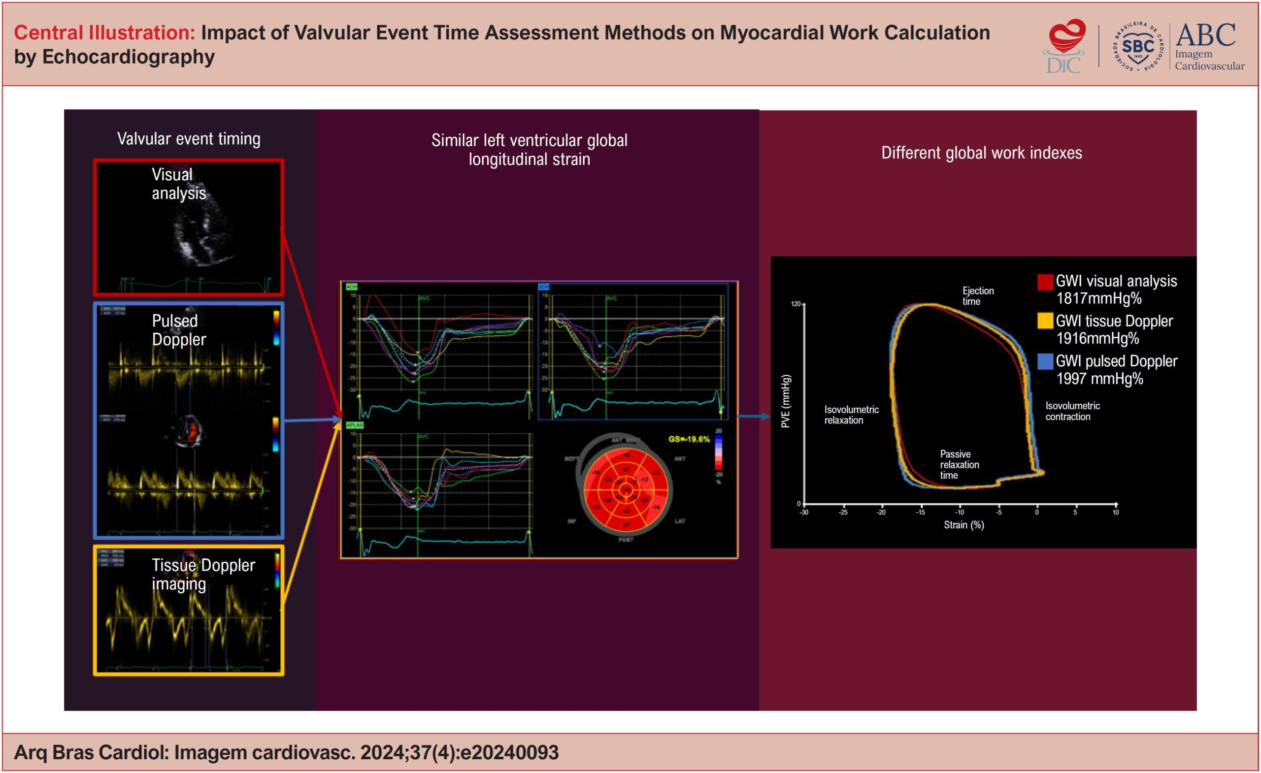 Impact of Valvular Event Time Assessment Methods on Myocardial Work Calculation by Echocardiography