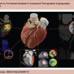 Coronary computed tomography angiography (CCTA) combining anatomy and functional assessment in the investigation of coronary disease. Central panel: three-dimensional reconstruction of the heart and coronary arteries. Upper left panel: 3D coronary tree with perfusion map of the left ventricle demonstrating the region irrigated by the affected artery. Lower left panel: fractional flow reserve derived from CTA (FFRct) with a value <0.80, compatible with flow-limiting stenosis. Lower panel: color-coded myocardial perfusion, demonstrating a perfusion defect under stress related to the region of the left anterior descending artery. Right panel: visual anatomical analysis by CCTA, demonstrating a sub-occlusive lesion in the left anterior descending artery.