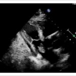 Figura 1