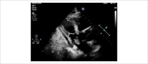 Figura 1