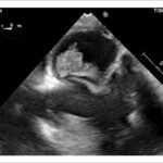 Figura 2