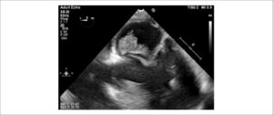 Figura 2