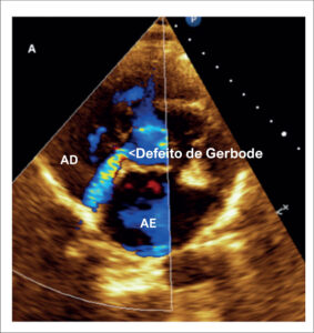 Figura 5