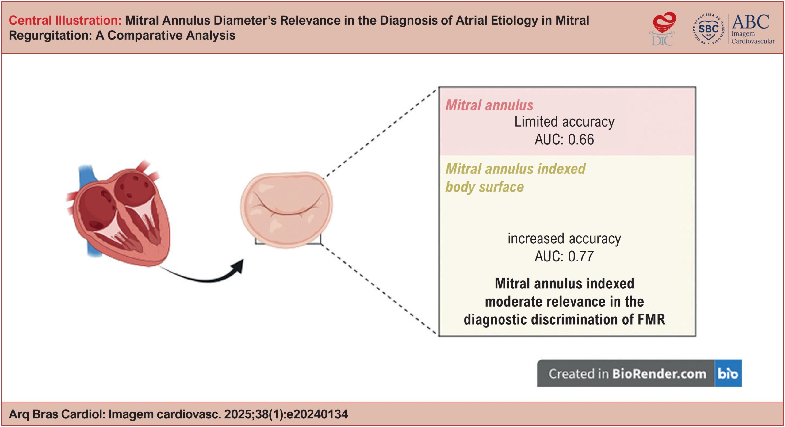 Mitral Annulus Diameter's Relevance in the Diagnosis of Atrial Etiology in Mitral Regurgitation: A Comparative Analysis